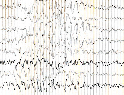 EEG path.